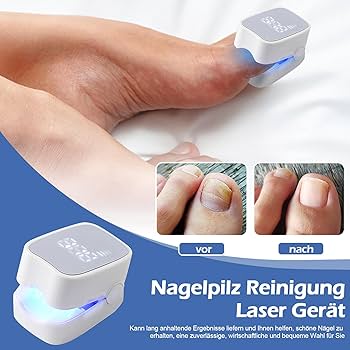 Laser Clean Pro® Tratamiento de hongos de uñas| Elimina Onicomicosis