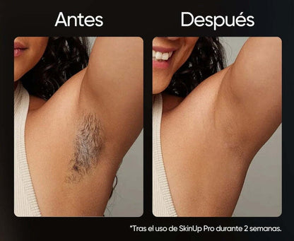 SkinUp Pro™ | Laser Permanente